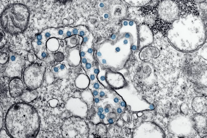 Sandpiper database cover image showing an electron microscope view of microbial structures, illustrating the hidden diversity studied in metagenomics.
